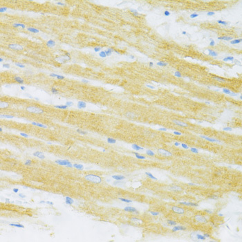 Immunohistochemistry - TYROBP Polyclonal Antibody 