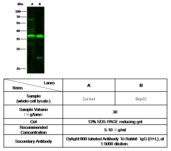 Anti-NT5C3A/UMPH1 antibody