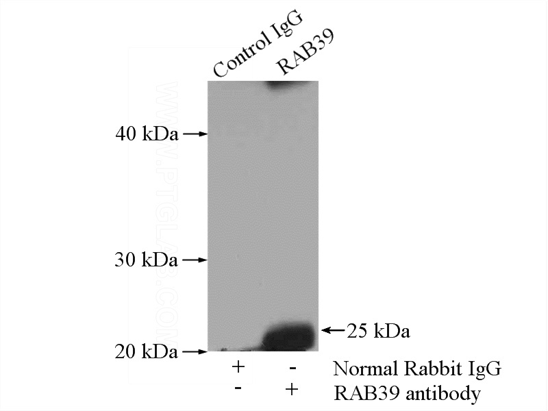 IP Result of anti-RAB39 (IP:Catalog No:114437, 4ug; Detection:Catalog No:114437 1:500) with mouse brain tissue lysate 4000ug.