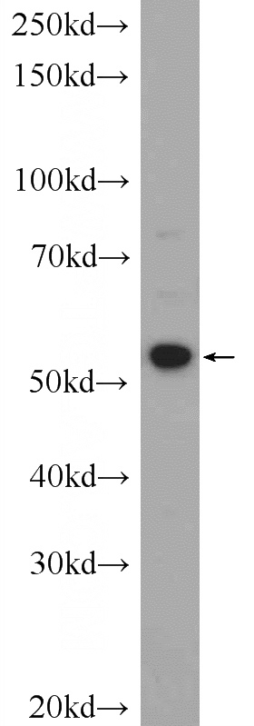 PC-3 cells were subjected to SDS PAGE followed by western blot with Catalog No:117154(ZNF277 Antibody) at dilution of 1:300