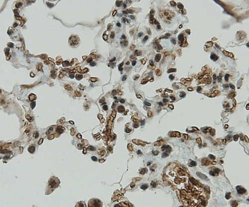 Fig3: Immunohistochemical analysis of paraffin-embedded human lung tissue using anti-CCDC51 antibody. Counter stained with hematoxylin.