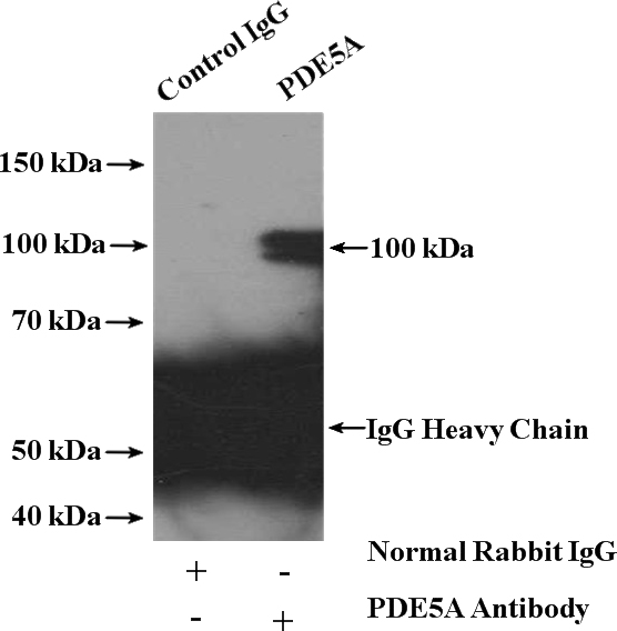 IP Result of anti-PDE5A (IP:Catalog No:113664, 4ug; Detection:Catalog No:113664 1:300) with SKOV-3 cells lysate 2800ug.