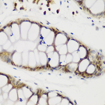 Immunohistochemistry - NCL Polyclonal Antibody 