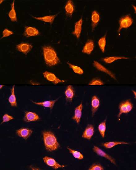 Immunofluorescence - PTCH1 Polyclonal Antibody 