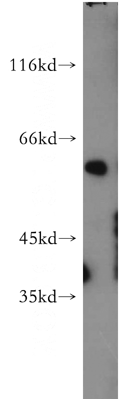 mouse skin tissue were subjected to SDS PAGE followed by western blot with Catalog No:113606(PAX3 antibody) at dilution of 1:500