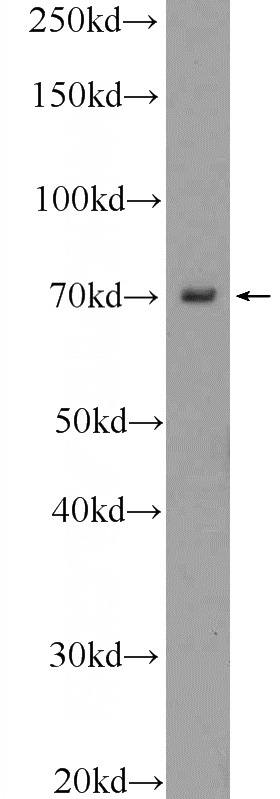 mouse eye tissue were subjected to SDS PAGE followed by western blot with Catalog No:116803(VSX1 Antibody) at dilution of 1:300