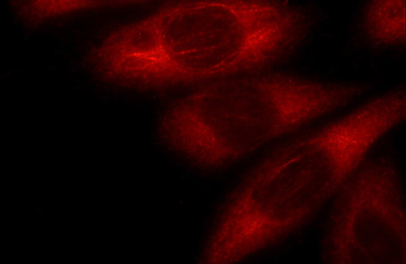 Immunofluorescent analysis of HeLa cells using Catalog No:108872(Caspase 12 Antibody) at dilution of 1:25 and Rhodamine-Goat anti-Rabbit IgG