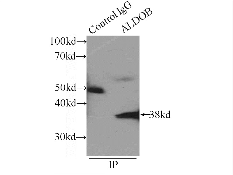 IP Result of anti-ALDOB (IP:Catalog No:107977, 4ug; Detection:Catalog No:107977 1:1000) with mouse kidney tissue lysate 4000ug.