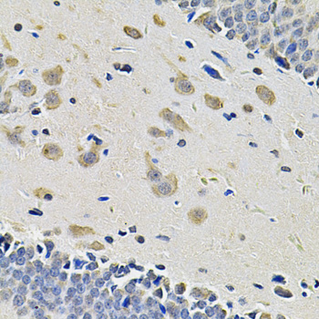 Immunohistochemistry - ITGA2 Polyclonal Antibody 