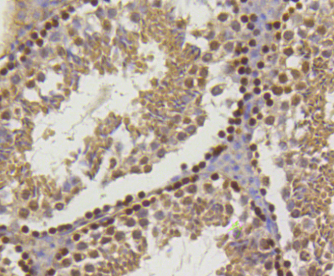 Immunohistochemistry - Hydroxyl-Histone H2A-Y39 Monoclonal Antibody 