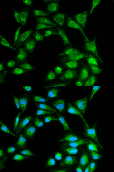Immunofluorescence - ICOS Polyclonal Antibody 