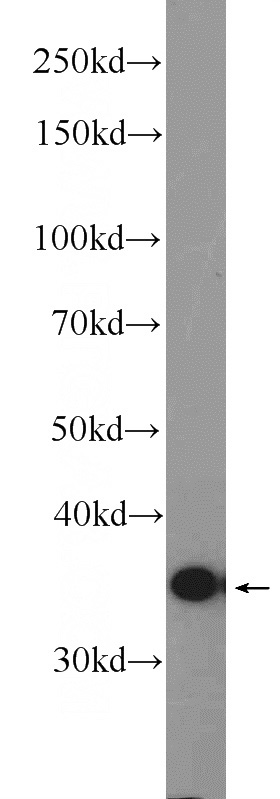 L02 cells were subjected to SDS PAGE followed by western blot with Catalog No:108724(C3orf38 Antibody) at dilution of 1:600