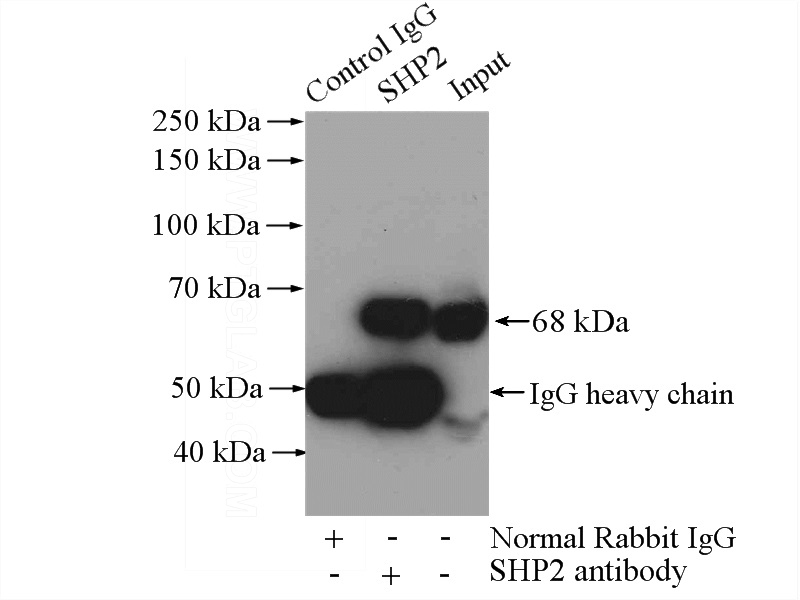 IP Result of anti-PTPN11 (IP:Catalog No:115280, 4ug; Detection:Catalog No:115280 1:1000) with HEK-293 cells lysate 2800ug.