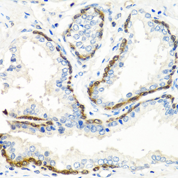 Immunohistochemistry - BMP5 Polyclonal Antibody 
