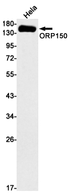 Western blot detection of ORP150 in Hela cell lysates using ORP150 Rabbit mAb(1:1000 diluted).Predicted band size:111kDa.Observed band size:150kDa.