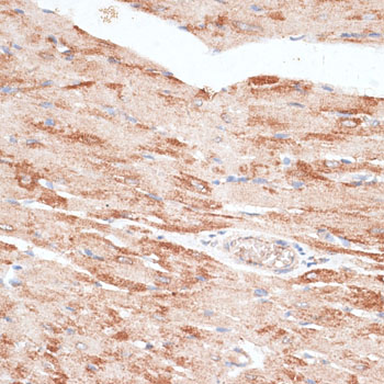 Immunohistochemistry - KIR3DL3 Polyclonal Antibody 