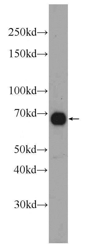 mouse heart tissue were subjected to SDS PAGE followed by western blot with Catalog No:109854(DACH2 Antibody) at dilution of 1:600