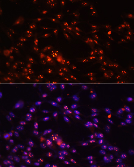 Immunofluorescence - DKC1 Polyclonal Antibody 