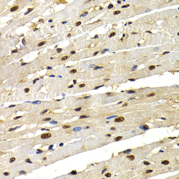 Immunohistochemistry - IRF2 Polyclonal Antibody 