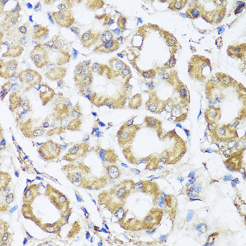 Immunohistochemistry - B9D1 Polyclonal Antibody 