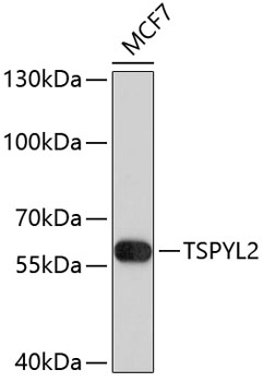 Western blot - TSPYL2 Polyclonal Antibody 