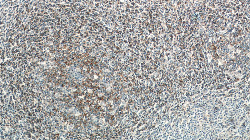 Immunohistochemistry of paraffin-embedded human tonsillitis slide using Catalog No:109032(CD37 Antibody) at dilution of 1:50
