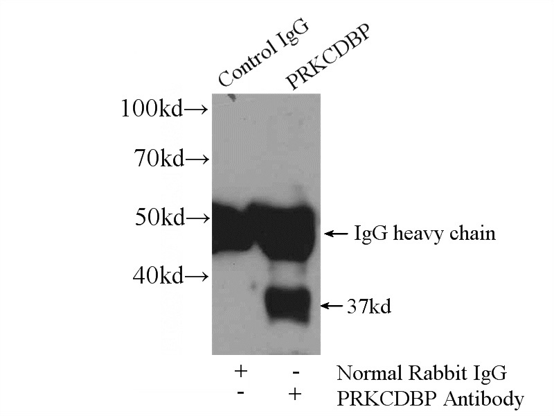 IP Result of anti-PRKCDBP (IP:Catalog No:114199, 4ug; Detection:Catalog No:114199 1:600) with mouse lung tissue lysate 2800ug.