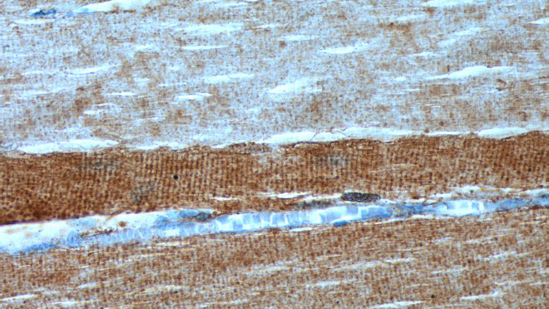 Immunohistochemistry of paraffin-embedded human skeletal muscle tissue slide using Catalog No:116568(ULK1 Antibody) at dilution of 1:200 (under 40x lens).