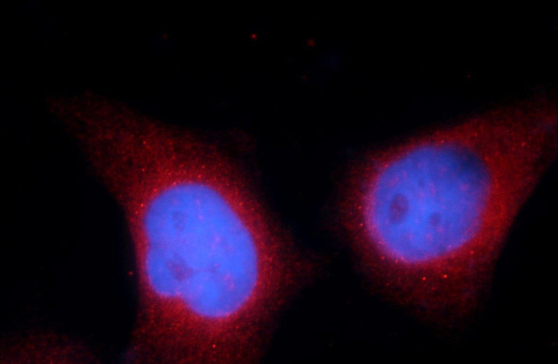 Immunofluorescent analysis of HepG2 cells using Catalog No:115707(STIM1 Antibody) at dilution of 1:25 and Rhodamine-Goat anti-Rabbit IgG