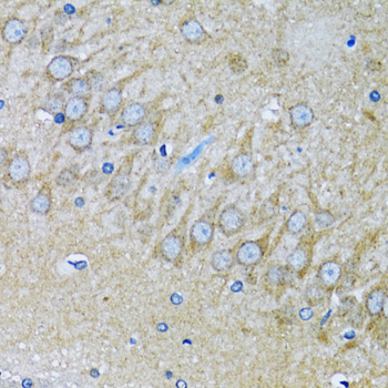 Immunohistochemistry - HDAC5 Polyclonal Antibody 
