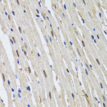 Immunohistochemistry - 53BP1 Polyclonal Antibody 