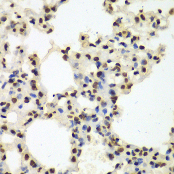 Immunohistochemistry - NONO Polyclonal Antibody 