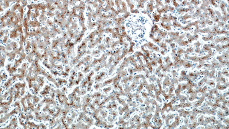 Immunohistochemical of paraffin-embedded human liver using Catalog No:107068(ASS1 antibody) at dilution of 1:50 (under 10x lens)