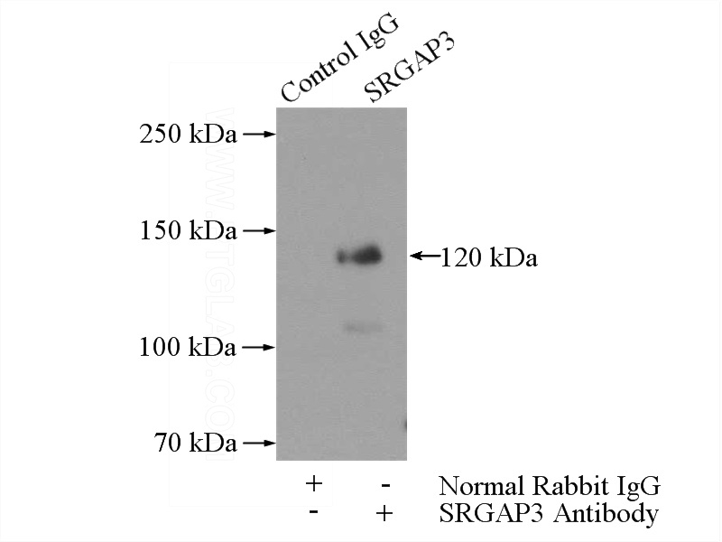 IP Result of anti-SRGAP3 (IP:Catalog No:115587, 5ug; Detection:Catalog No:115587 1:300) with mouse brain tissue lysate 4000ug.