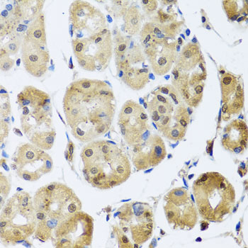 Immunohistochemistry - TAF15 Polyclonal Antibody 