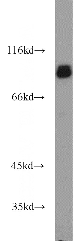 HEK-293 cells were subjected to SDS PAGE followed by western blot with Catalog No:116070(TLE3 antibody) at dilution of 1:1000