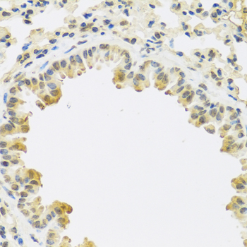 Immunohistochemistry - TGFB3 Polyclonal Antibody 