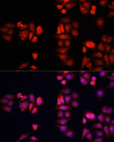 Immunofluorescence - BMP1 Polyclonal Antibody 
