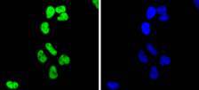 Fig2: ICC staining Histone H2B(acetyl K20) in Hela cells (green). The nuclear counter stain is DAPI (blue). Cells were fixed in paraformaldehyde, permeabilised with 0.25% Triton X100/PBS.