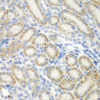 Immunohistochemistry - ASPSCR1 Polyclonal Antibody 
