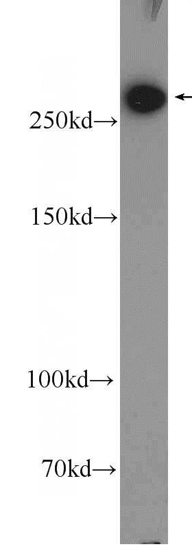 rat liver tissue were subjected to SDS PAGE followed by western blot with Catalog No:110529(FASN Antibody) at dilution of 1:300
