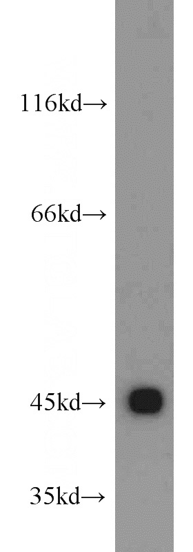 HEK-293 cells were subjected to SDS PAGE followed by western blot with Catalog No:109727(CTNS antibody) at dilution of 1:500