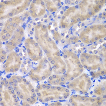 Immunohistochemistry - ASPSCR1 Polyclonal Antibody 