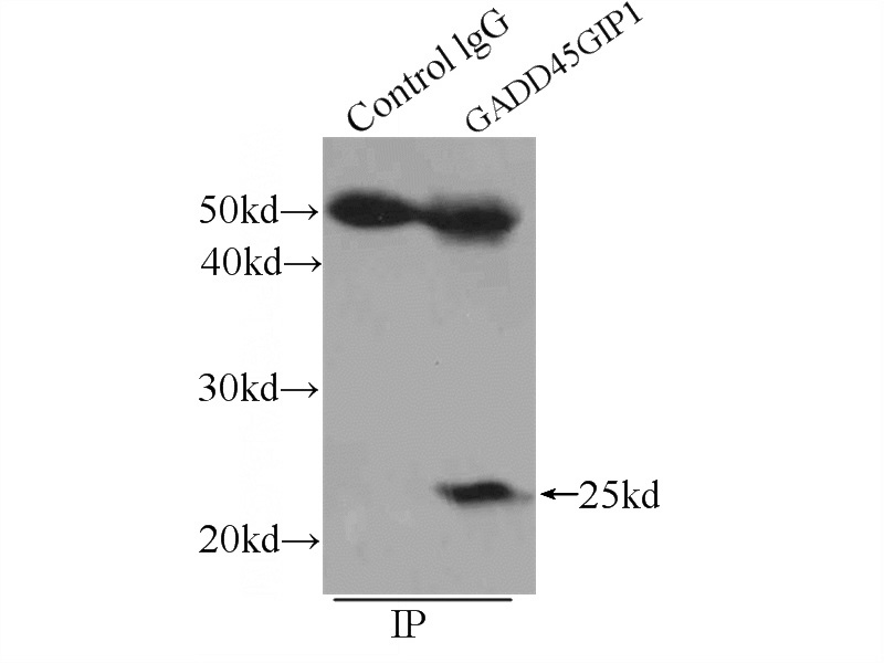 IP Result of anti-GADD45GIP1 (IP:Catalog No:110822, 4ug; Detection:Catalog No:110822 1:400) with mouse heart tissue lysate 4000ug.