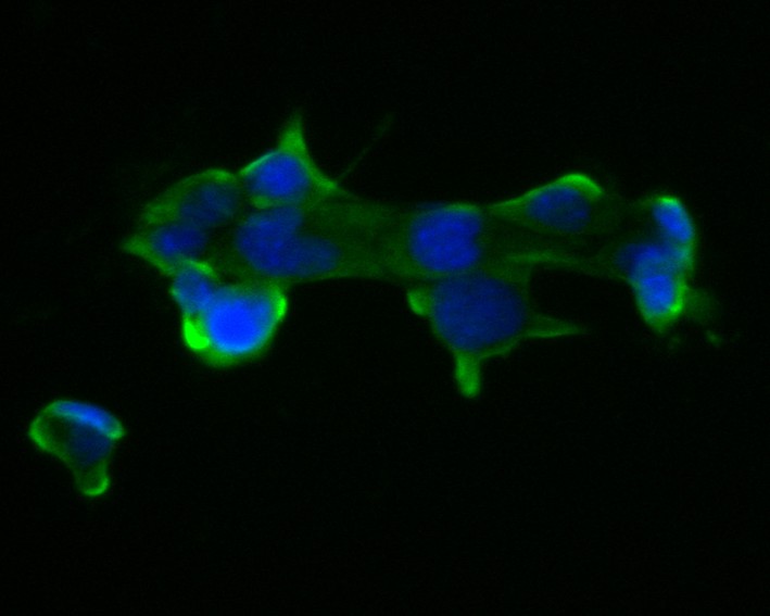 Fig2:; ICC staining of PAK3 in F9 cells (green). Formalin fixed cells were permeabilized with 0.1% Triton X-100 in TBS for 10 minutes at room temperature and blocked with 1% Blocker BSA for 15 minutes at room temperature. Cells were probed with the primary antibody ( 1/50) for 1 hour at room temperature, washed with PBS. Alexa Fluor®488 Goat anti-Rabbit IgG was used as the secondary antibody at 1/1,000 dilution. The nuclear counter stain is DAPI (blue).