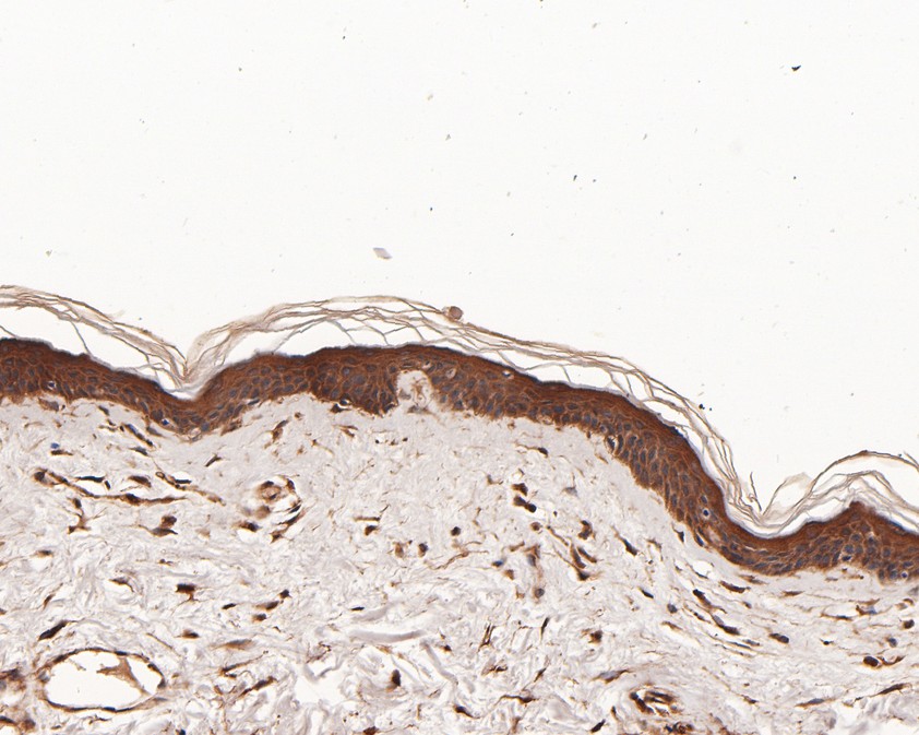 Fig4:; Immunohistochemical analysis of paraffin-embedded human skin tissue using anti-NPY5R antibody. The section was pre-treated using heat mediated antigen retrieval with Tris-EDTA buffer (pH 9.0) for 20 minutes.The tissues were blocked in 5% BSA for 30 minutes at room temperature, washed with ddH; 2; O and PBS, and then probed with the primary antibody ( 1/50) for 30 minutes at room temperature. The detection was performed using an HRP conjugated compact polymer system. DAB was used as the chromogen. Tissues were counterstained with hematoxylin and mounted with DPX.