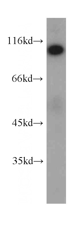 human heart tissue were subjected to SDS PAGE followed by western blot with Catalog No:107306(HSP90B1 antibody) at dilution of 1:1000