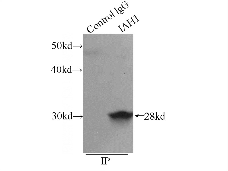 IP Result of anti-IAH1 (IP:Catalog No:111581, 3ug; Detection:Catalog No:111581 1:500) with mouse kidney tissue lysate 5000ug.