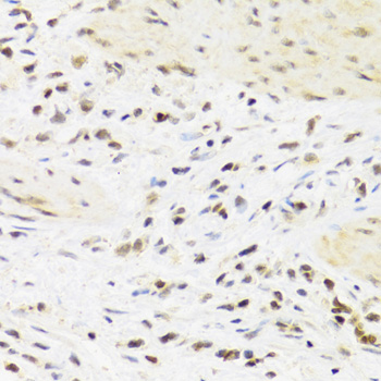 Immunohistochemistry - SUMO4 Polyclonal Antibody 
