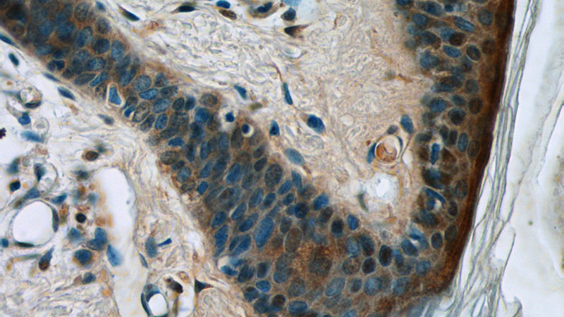 Immunohistochemistry of paraffin-embedded human skin tissue slide using Catalog No:110004(DMKN Antibody) at dilution of 1:50 (under 40x lens)